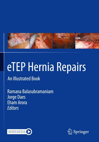eTEP Hernia Repairs
