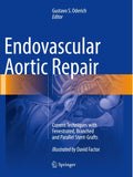 Endovascular Aortic Repair