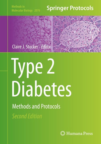 Type 2 Diabetes