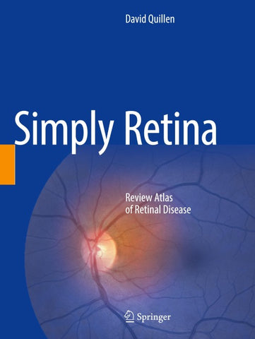 Simply Retina