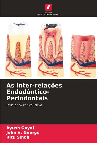 As Inter-relações Endodôntico-Periodontais