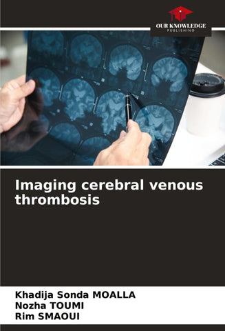 Imaging cerebral venous thrombosis