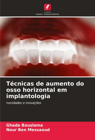 Técnicas de aumento do osso horizontal em implantologia