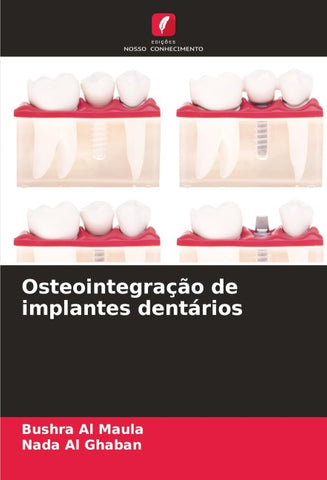 Osteointegração de implantes dentários