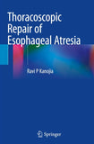 Thoracoscopic Repair of Esophageal Atresia
