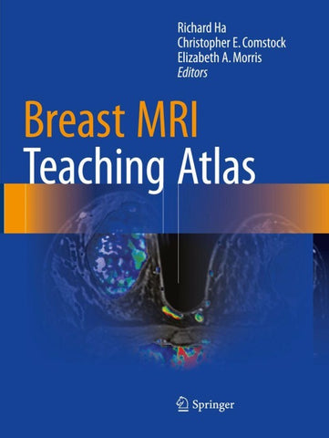 Breast MRI Teaching Atlas