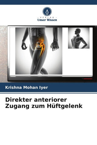 Direkter anteriorer Zugang zum Hüftgelenk