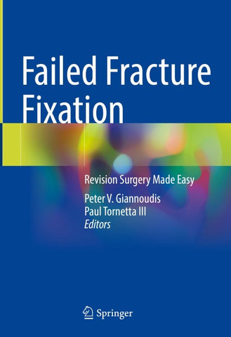 Failed Fracture Fixation