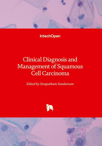 Clinical Diagnosis and Management of Squamous Cell Carcinoma