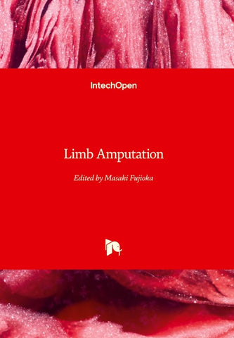 Limb Amputation