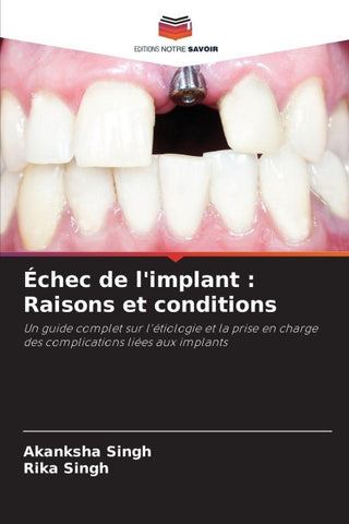 Échec de l'implant : Raisons et conditions