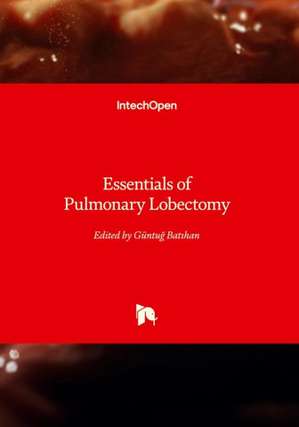 Essentials of Pulmonary Lobectomy