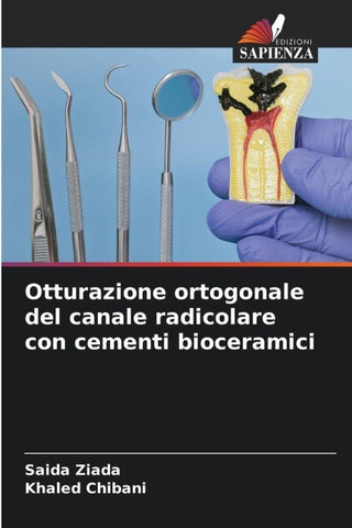 Otturazione ortogonale del canale radicolare con cementi bioceramici
