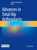 Advances in Total Hip Arthroplasty