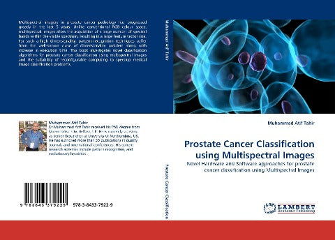 Prostate Cancer Classification using Multispectral Images