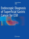 Endoscopic Diagnosis of Superficial Gastric Cancer for ESD