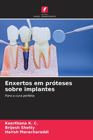 Enxertos em próteses sobre implantes