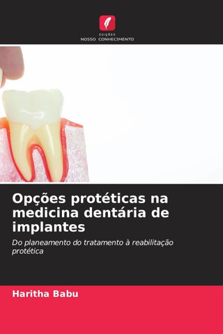 Opções protéticas na medicina dentária de implantes