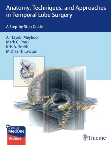 Anatomy, Techniques, and Approaches in Temporal Lobe Surgery