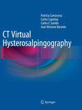 CT Virtual Hysterosalpingography