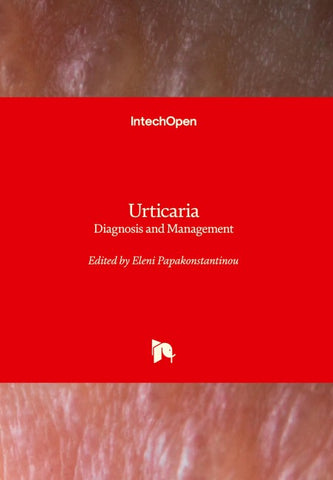 Urticaria
