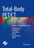 Total-Body PET/CT