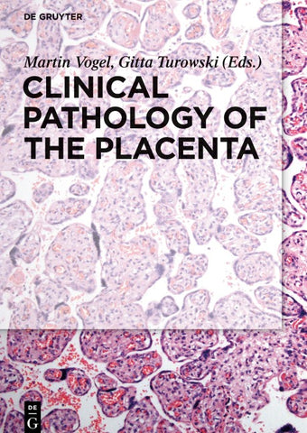 Clinical Pathology of the Placenta