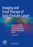 Imaging and Focal Therapy of Early Prostate Cancer