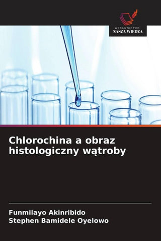 Chlorochina a obraz histologiczny w¿troby