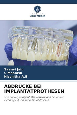 ABDRÜCKE BEI IMPLANTATPROTHESEN