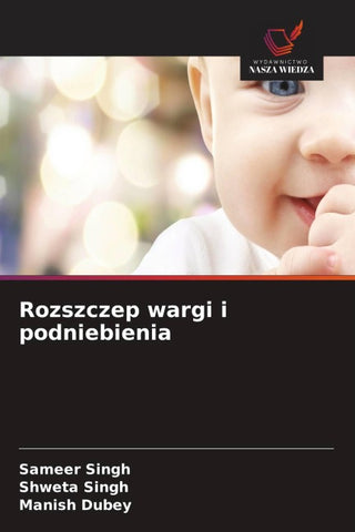Rozszczep wargi i podniebienia