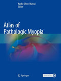 Atlas of Pathologic Myopia