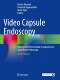 Video Capsule Endoscopy