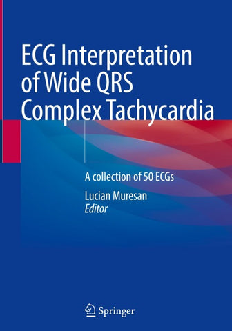 ECG Interpretation of Wide QRS Complex Tachycardia