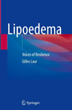 Lipoedema