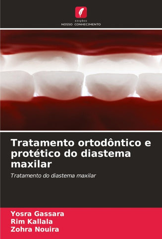 Tratamento ortodôntico e protético do diastema maxilar