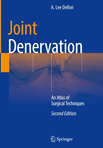 Joint Denervation