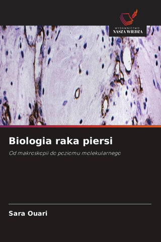 Biologia raka piersi