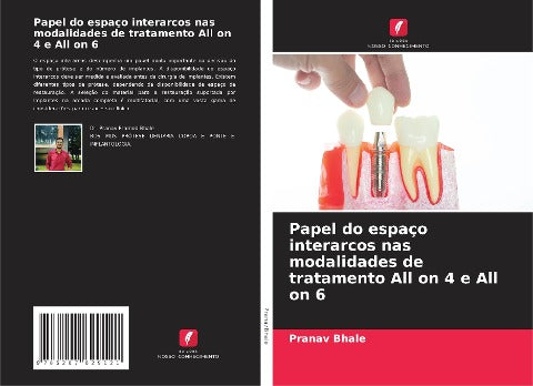 Papel do espaço interarcos nas modalidades de tratamento All on 4 e All on 6