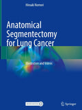 Anatomical Segmentectomy for Lung Cancer