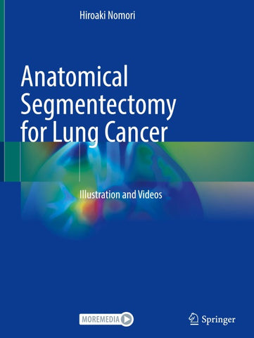 Anatomical Segmentectomy for Lung Cancer