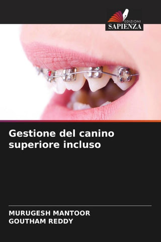 Gestione del canino superiore incluso