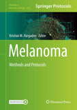Melanoma