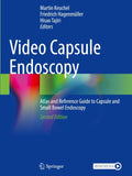 Video Capsule Endoscopy