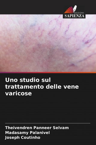 Uno studio sul trattamento delle vene varicose