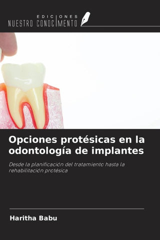 Opciones protésicas en la odontología de implantes