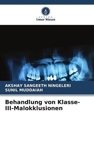 Behandlung von Klasse-III-Malokklusionen