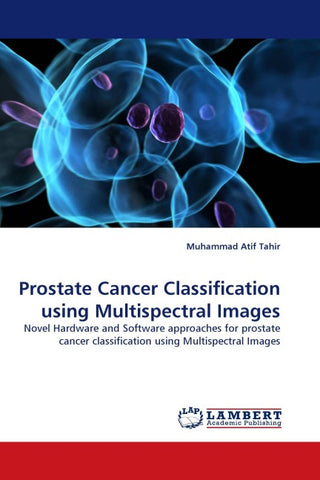 Prostate Cancer Classification using Multispectral Images