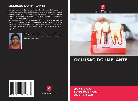 OCLUSÃO DO IMPLANTE