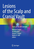 Lesions of the Scalp and Cranial Vault